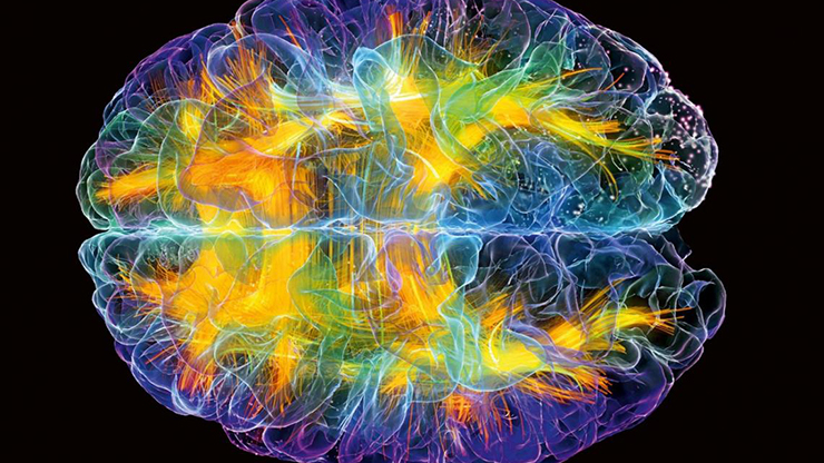 ¿El cerebro se reduce con la edad?